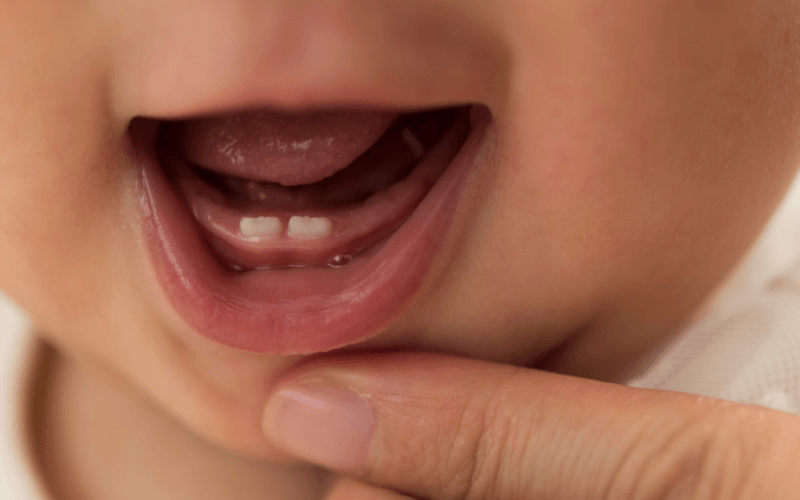 4 Important Tips For Your Baby's Teeth