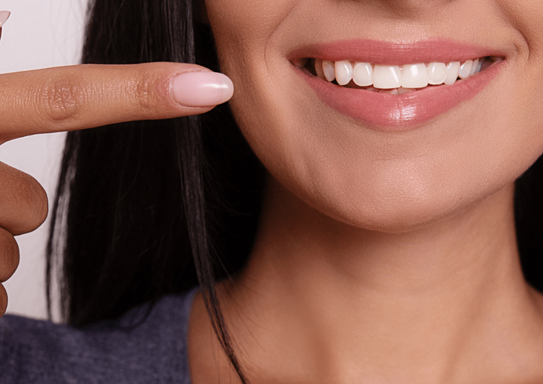3 Simple Steps To Maintain Perfect Pearly Whites