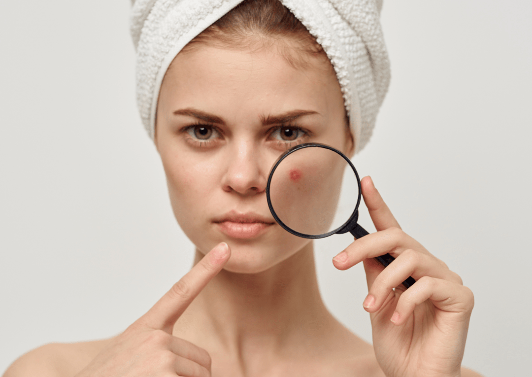 7 Steps to Overcome Skin Problems And Boost Your Confidence